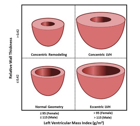 increased lv wall thickness|left ventricular hypertrophy wall thickness.